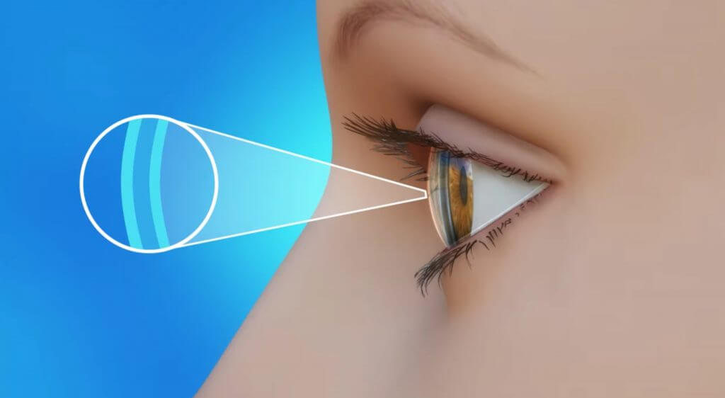 dry eyes in the morning