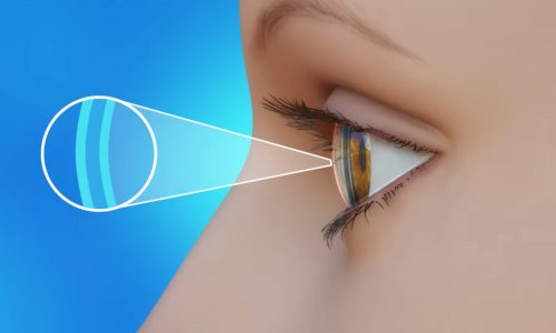 dry eyes in the morning