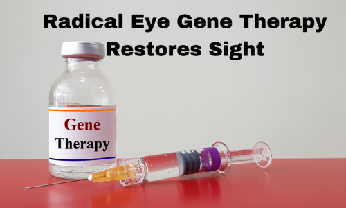 Eye Gene Therapy Featured