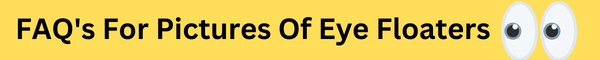 FAQ's For Pictures Of Eye Floaters