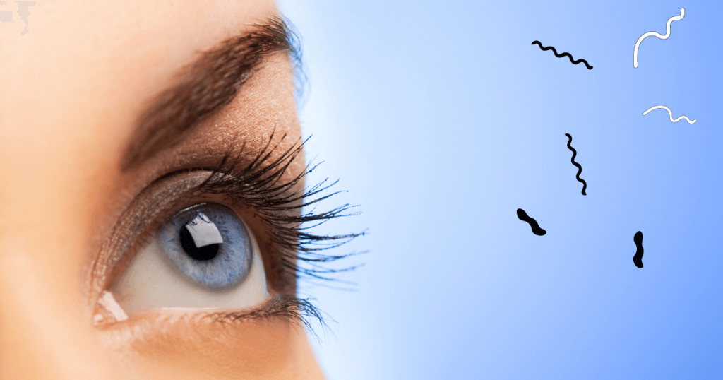 Pictures Of Eye Floaters
