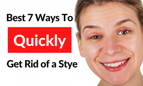 Best 7 Ways to Quickly Get Rid of a Stye! 13 Get Rid Of A Stye Featured