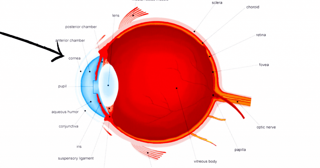 Keratoconus Is A Rare Eye Condition
