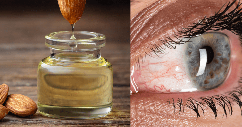 6 Foods That Will Moisturize Your Dry Eyes Thirst In A Jiffy 1 Moisturize Your Dry Eyes