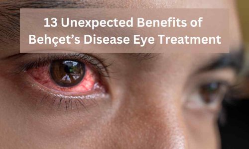 13 Unexpected Benefits of Behçets Disease Eye Treatment 1 13 Unexpected Benefits of Behçet’s Disease Eye Treatment