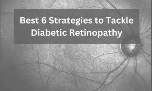 Best 6 Strategies to Tackle Diabetic Retinopathy 62 Best 6 Strategies to Tackle Diabetic Retinopathy