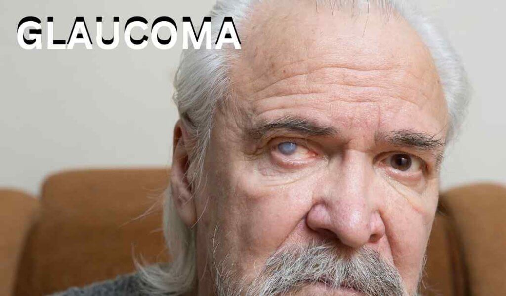 Glaucoma
