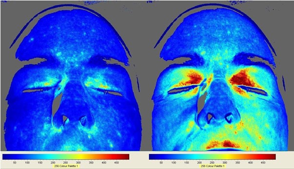 How Grounding Can Improve Vision in Seniors