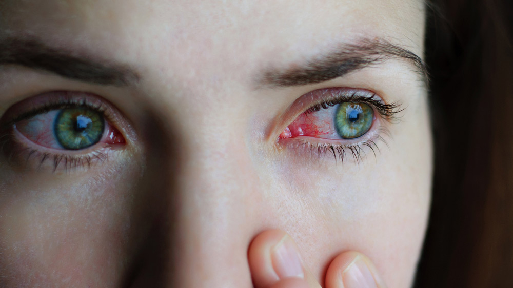 6 Unbeatable Tips to Prevent Eye Injuries in Athletes